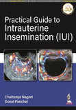 Practical Guide to Intrauterine Insemination (IUI)