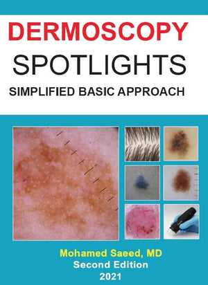 Dermoscopy Spotlights : Simplified Basic Approach, 2e