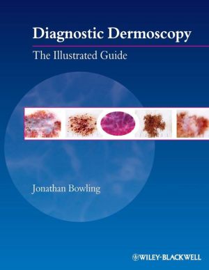 Diagnostic Dermoscopy: The Illustrated Guide**