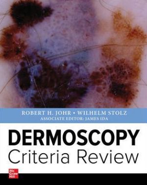 Dermoscopy Criteria Revie