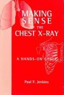 Making Sense of the Chest X-ray : A hands-on guide**