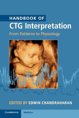 Handbook of CTG Interpretation