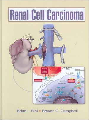 Renal Cell Carcinoma