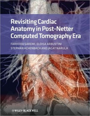 Revisiting Cardiac Anatomy: A Computed-Tomography-Based Atlas and Reference