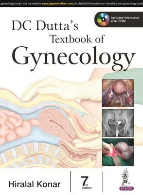 DC Dutta's Textbook of Gynecology, 7e