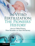 In-Vitro Fertilization